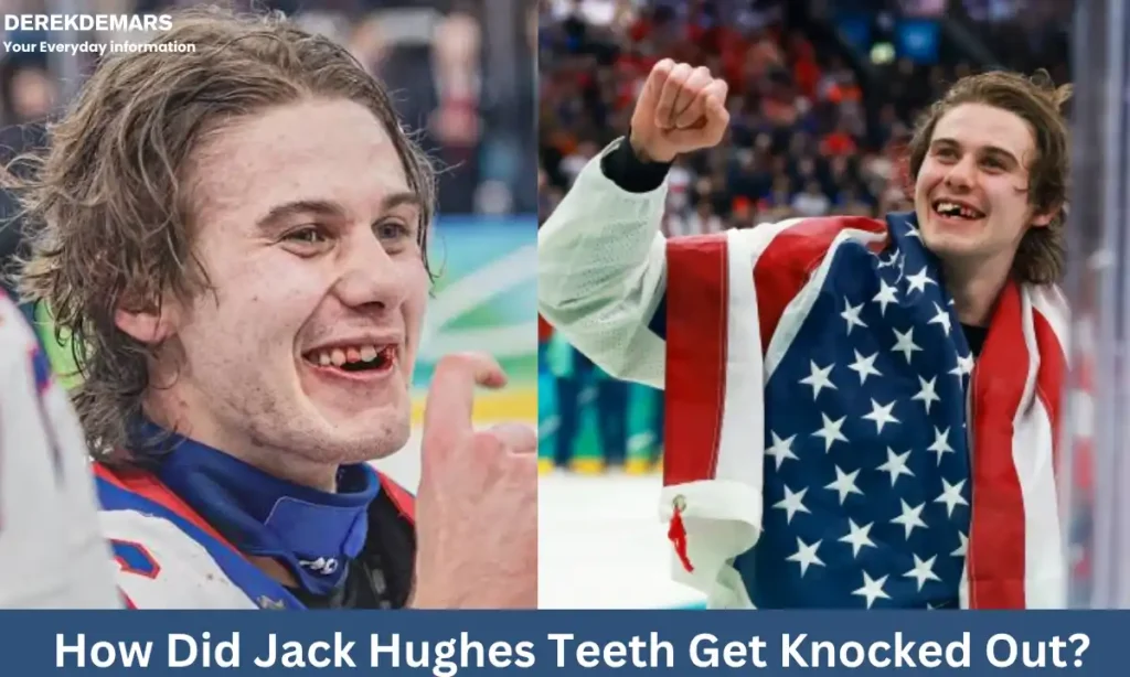 Jack Hughes Teeth