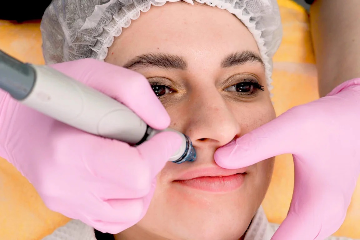 The Complete Guide to Understanding Hydrafacial Treatments and Their Skin Benefits